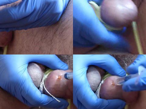 Chemical Castration - young boy Ethanol Injections - jav xnxx Second Round